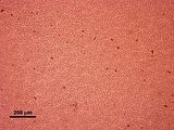 3 - Cellule corticali in visione superficiale
